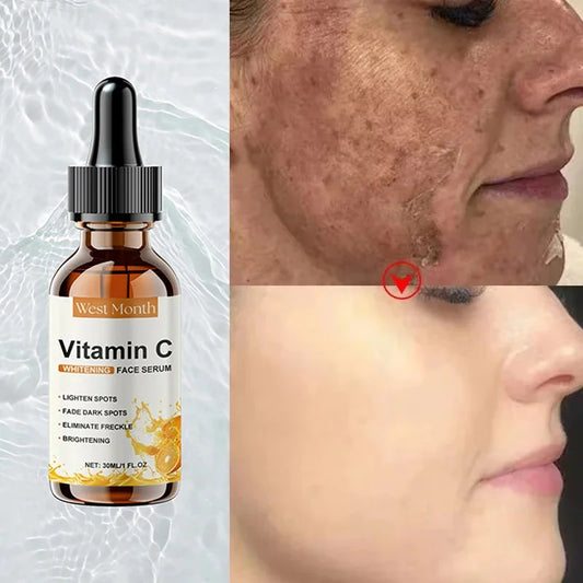 Vitamin C Whitening Serum