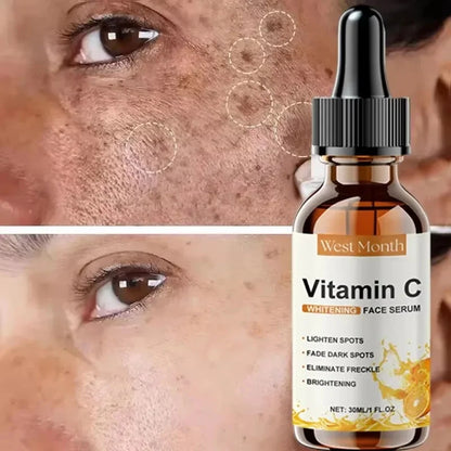 Vitamin C Whitening Serum