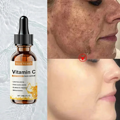 Vitamin C Whitening Serum