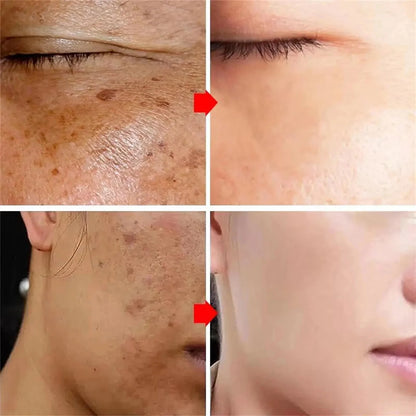 Vitamin C Whitening Serum